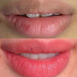 Chăm sóc môi sau khi phun: Những điều cần biết để màu môi lên đẹp